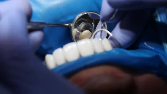Day 2 Advanced Korean Dental Technology For Lasting Beauty