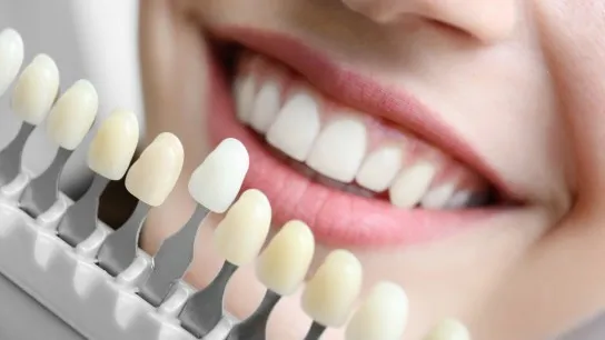 Day 2 Brighten Your Smile With Professional Teeth Whitening In Vietnam
