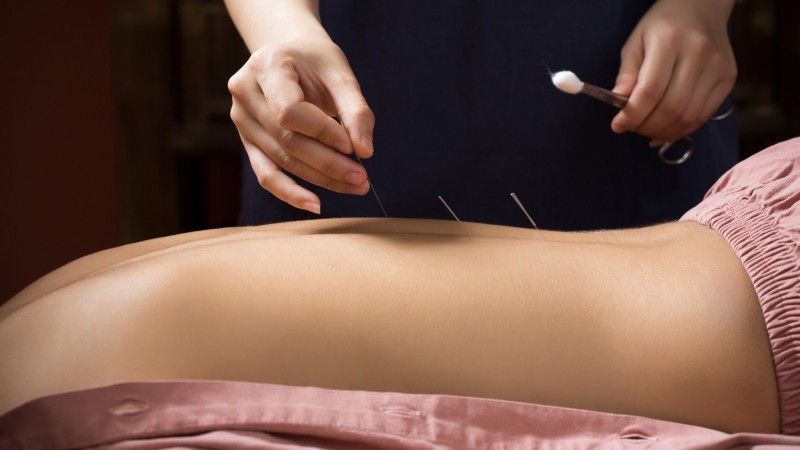 Day 2 Enhance Wellness With A Restorative Acupuncture Session