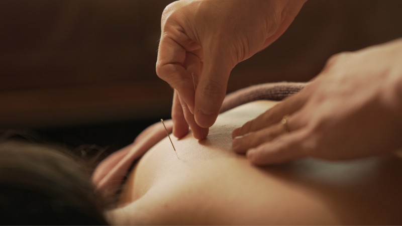 Day 5 Rejuvenate With A Relaxing Acupuncture Session